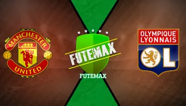 Manchester United x Lyon Manchester United x Lyon